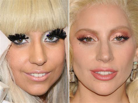 lady gaga surgery|Inside Lady Gaga’s body and face transformation: see。